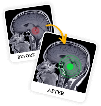 What is Billionaire Brain Wave?